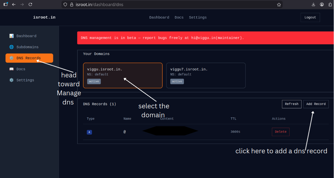 DNS management screenshot